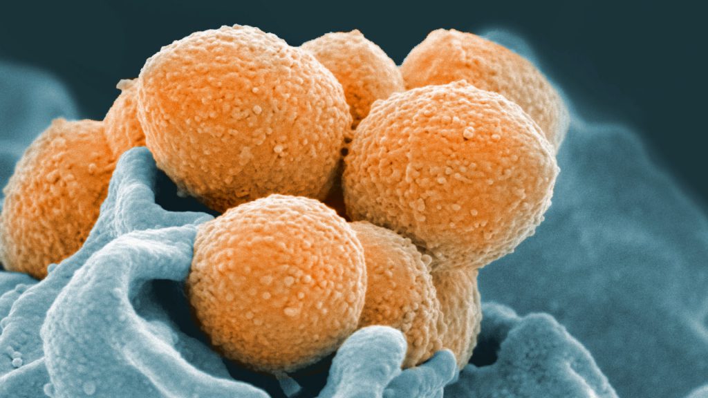 IVI Director General addresses 'neglected diseases' in STAT News
