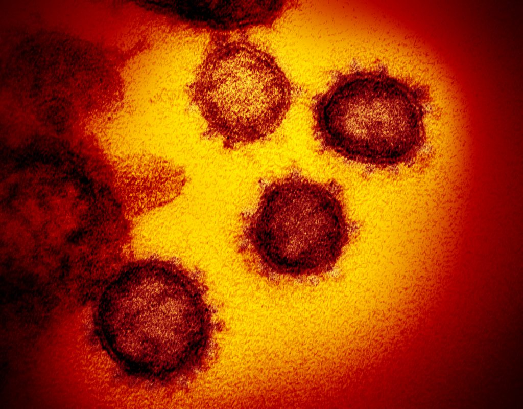 Korea should join efforts in vaccine development to prevent pandemics (JoongAng Ilbo)