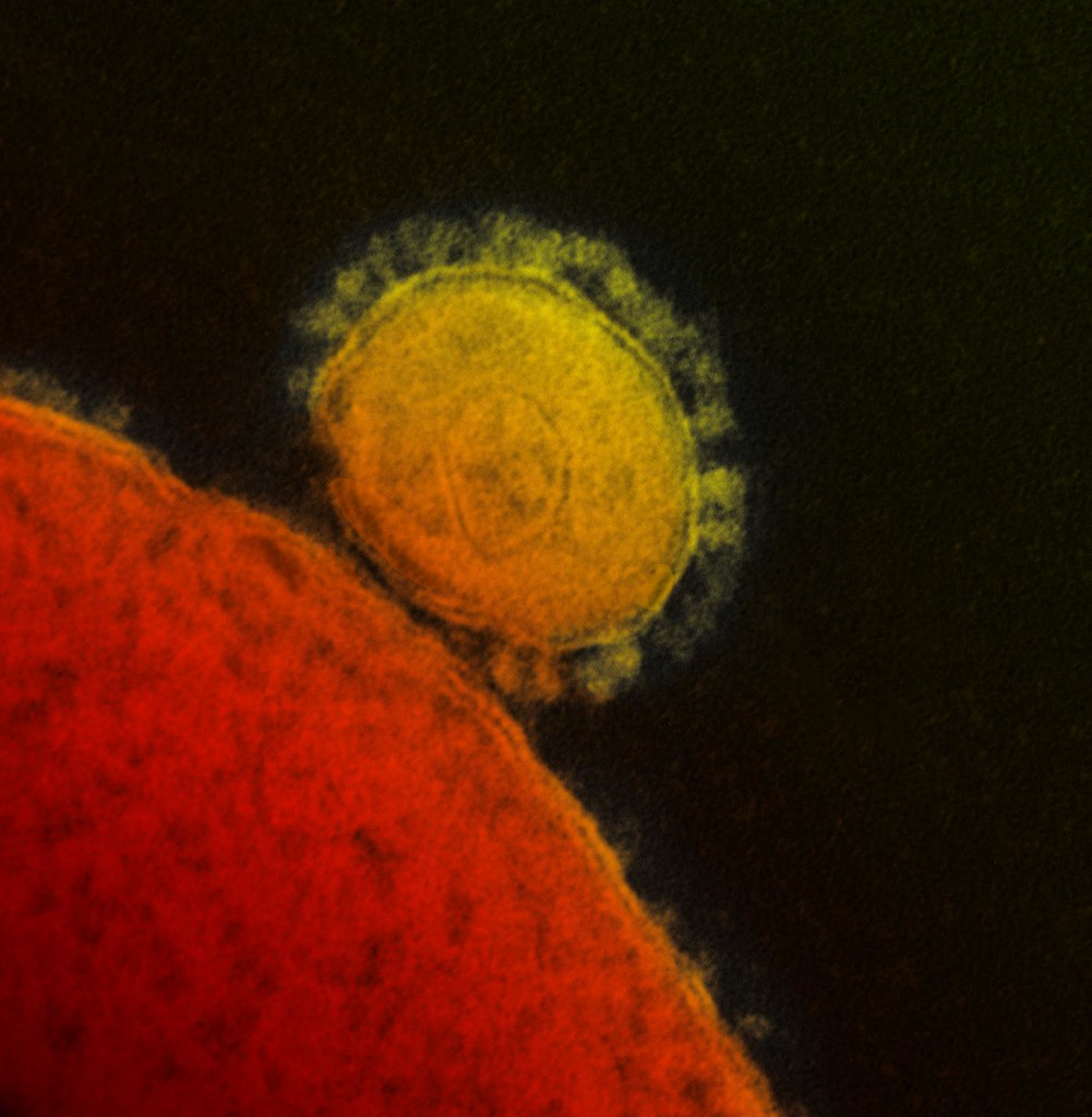 INOVIO and GeneOne Life Science Report Positive Phase 1/2a Clinical Data With DNA Vaccine INO-4700 for MERS Coronavirus at the American Society of Gene & Cell Therapy (ASGCT) Conference